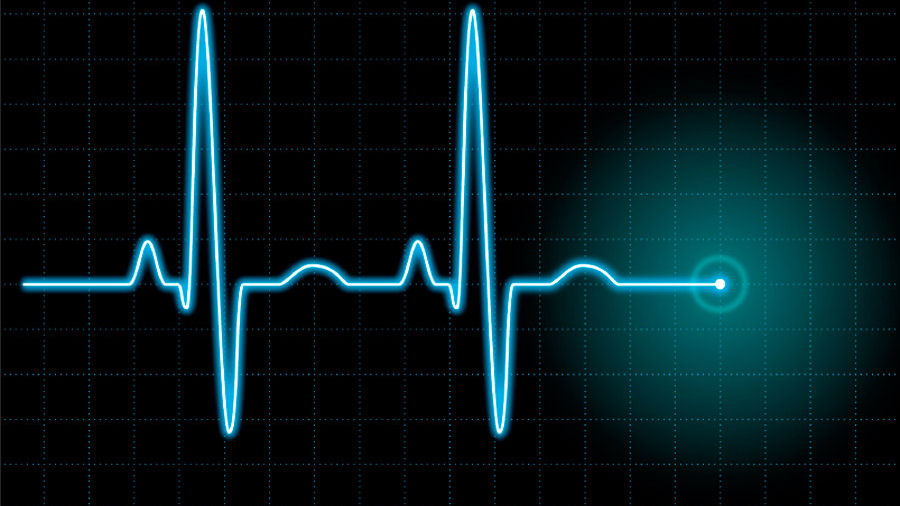 En spelbransch i koma